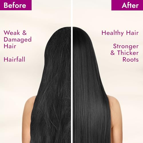 Parachute Advansed Onion enriched coconut hair Oil, 300ml - Image 6