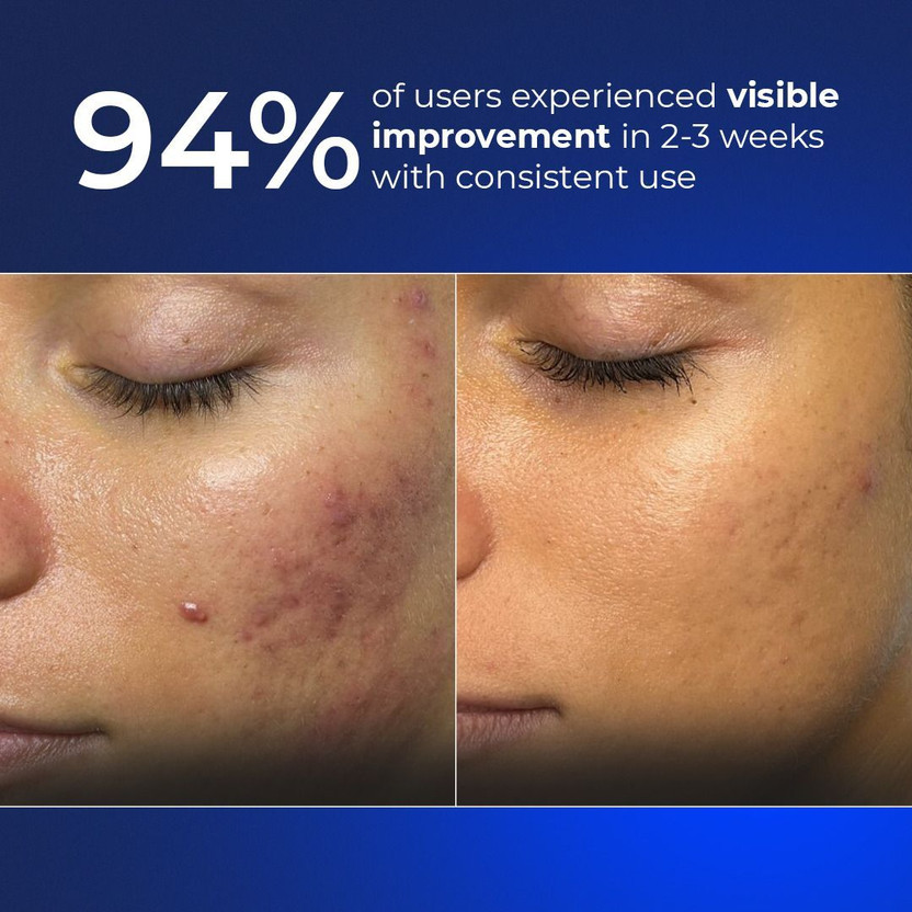 Aqueria 3% Niacinamide Hydrating &