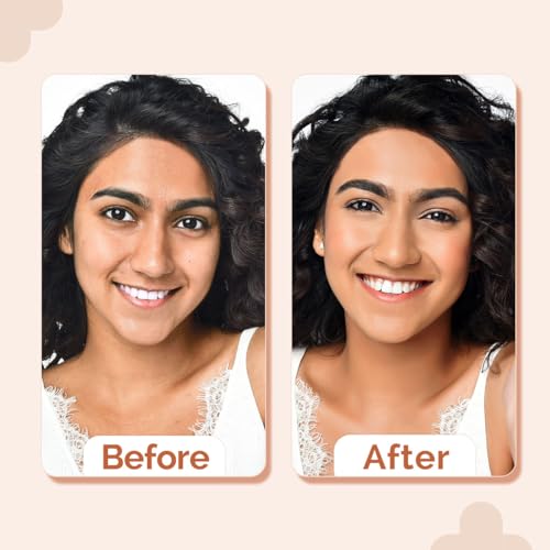 The Derma Co Matte 2%