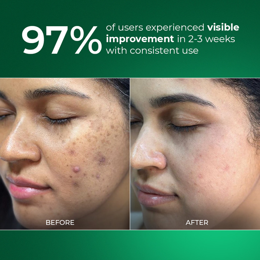Aqueria 3% Niacinamide Oil Control