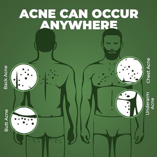 Beardo Body Acne Clear Body
