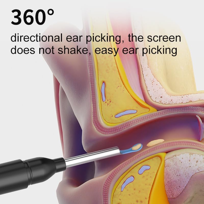 AVNISH Earocam Earwax Removal Tool