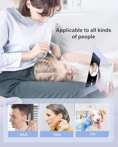 AVNISH Earocam Earwax Removal Tool