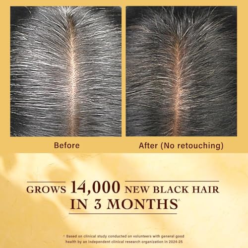 Indulekha Jatamansi Premature Greying Treatment