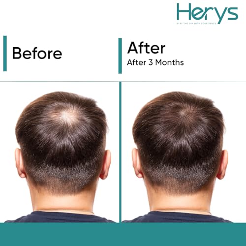 Herys Rosemary Hair Growth Serum