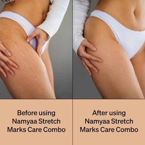 Namyaa Stretch Marks Care Combo|Body