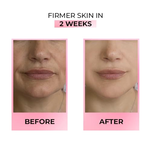 Streax Youthful Shine Face Serum
