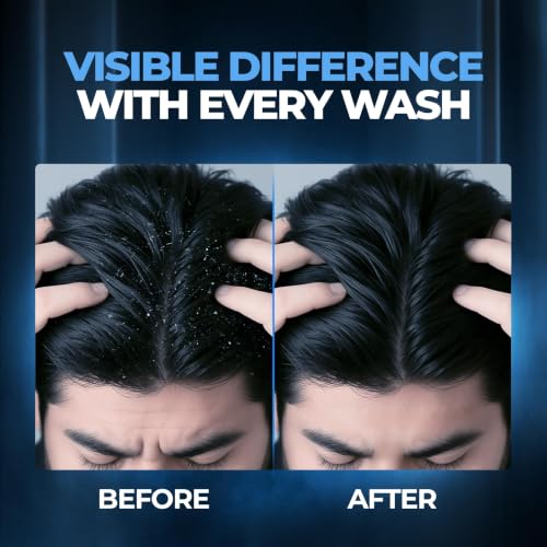 Beardo Dandruff Control Sulphate Free