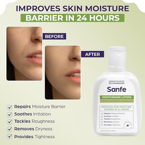 Sanfe Moisturising Lotion | Improves