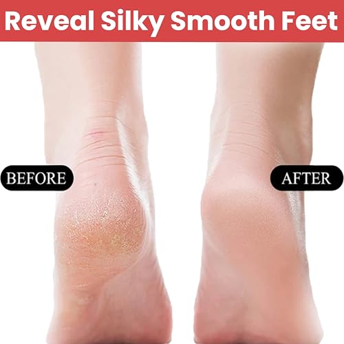 TEMPERIA Foot Scrubber for Dead