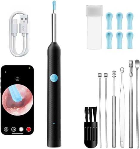 Ear Wax Removal with Camera