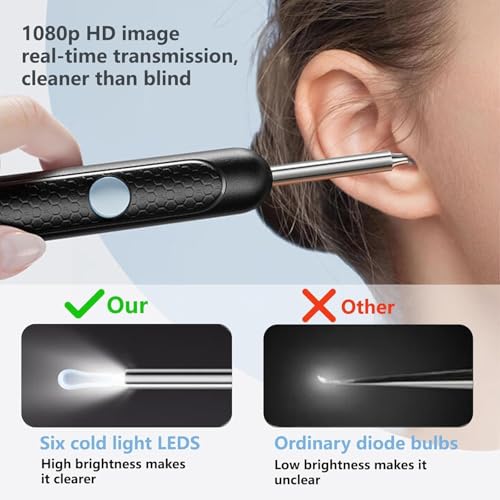 Ear Wax Removal with Camera