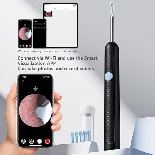 Ear Wax Removal with Camera