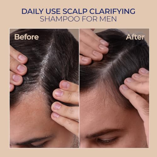 Naturali Scalp Clarifying Anti-Dandruff Shampoo
