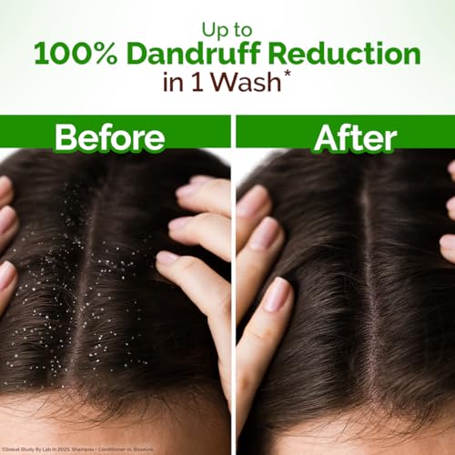 Mamaearth Lemon Anti-Dandruff Shampoo