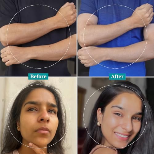 Pilgrim 25% AHA 2% BHA 5% PHA Peeling Solution for Tan Removal - 10ml - Image 5