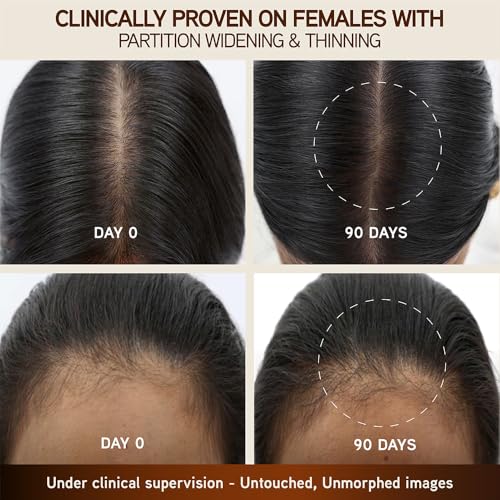 Indulekha Bringha Hair Growth Treatment