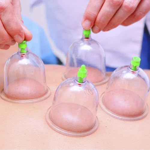 12 Pcs Vacuum Cupping Therapy