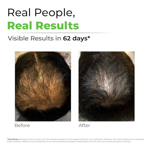 Avimee Herbal Keshpallav Hair Oil