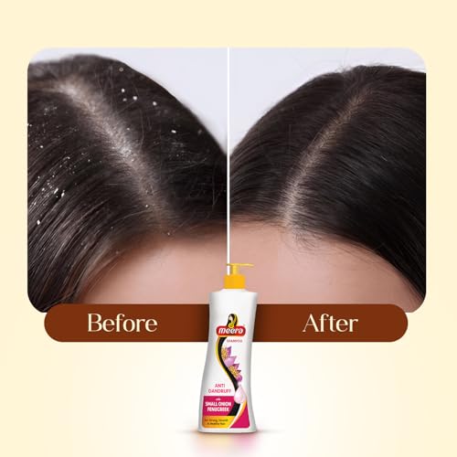 Meera Anti-Dandruff Shampoo, With Small Onion and Fenugreek, 340ml - Image 7