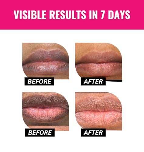 Pink Lips Therapy: 2-in-1 Lip