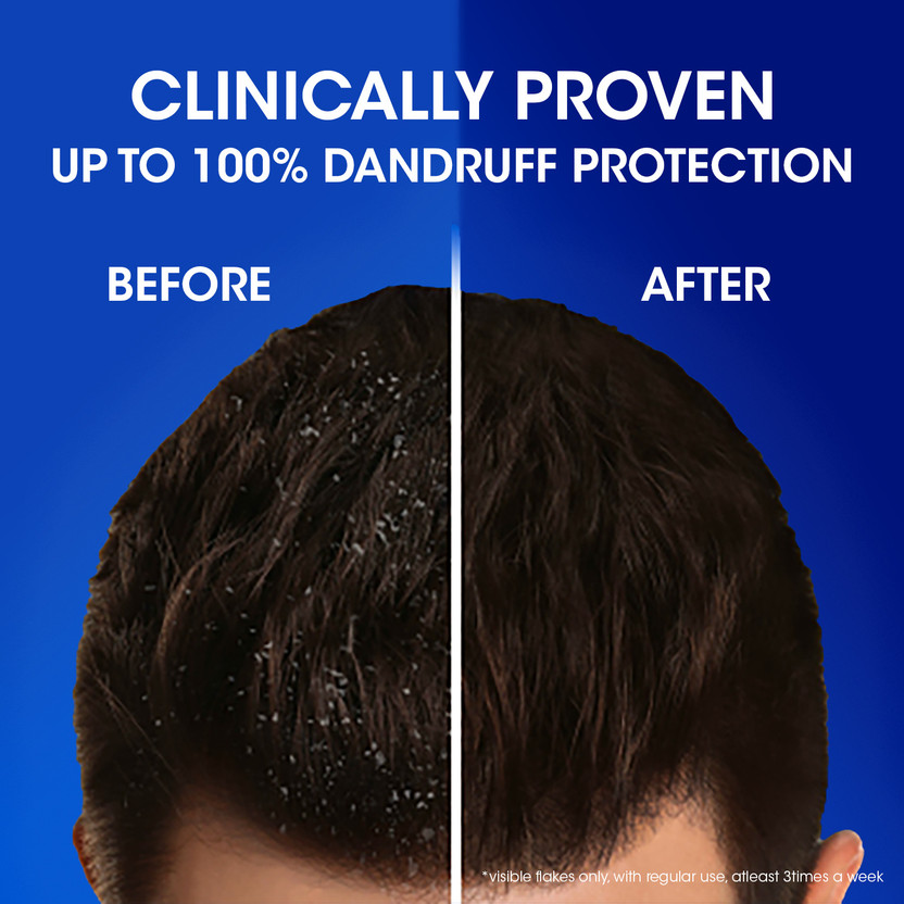 HEAD & SHOULDERS Smooth